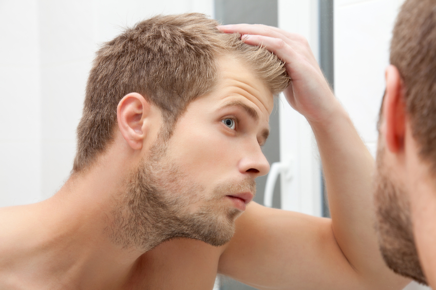how to reverse hair loss and regrow your hair (naturally)